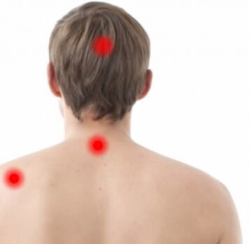 Osteokondroz odakları