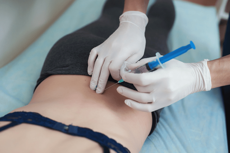 lomber osteokondrozda blokaj